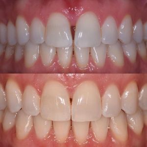 Image post by @sharpdentistry on Instagram
