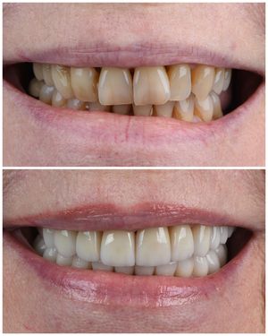 Image post by @sharpdentistry on Instagram