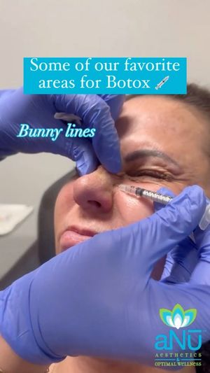 Video post by @anuaestheticsandwellness on Instagram