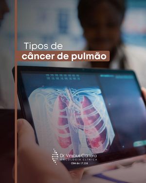 Image post by @drviniciuscarrera on Instagram
