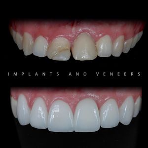 Image post by @sharpdentistry on Instagram