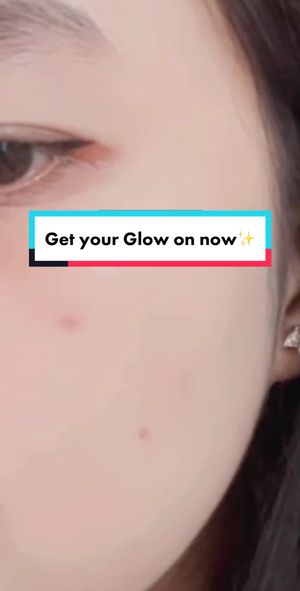 Video post by @lili.refliskin on TikTok