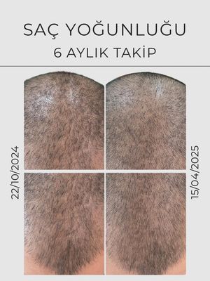 Image post by @drozlemteberik on Instagram