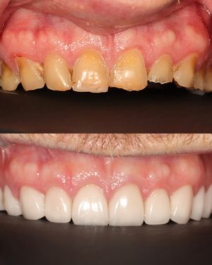Image post by @fahaddentist on Instagram