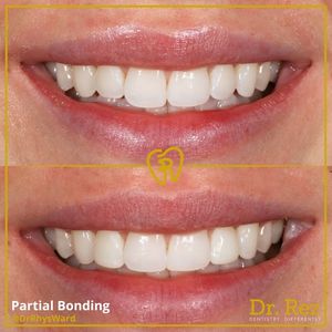Image post by @drrezdental on Facebook