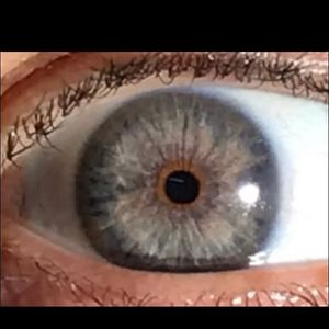 Image post by @irexlaser on Instagram