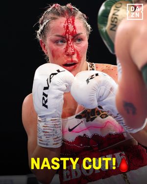 Image post by @daznboxing on Instagram