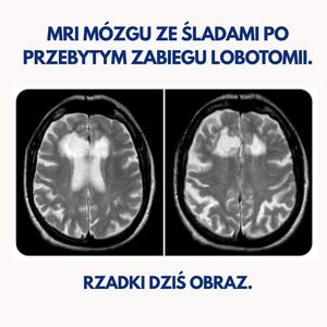 Image post by @neurochirurg_litak on Instagram