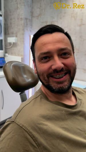 Video post by @drrezdental on Facebook