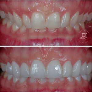 Image post by @sharpdentistry on Instagram