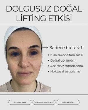 Image post by @drozlemteberik on Instagram
