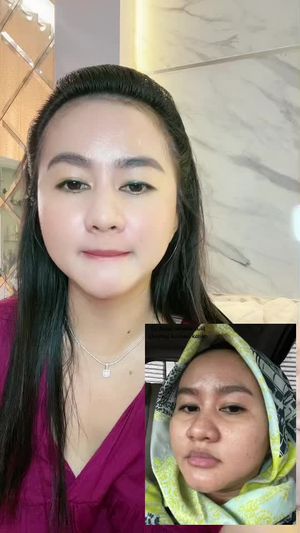Video post by @lili.refliskin on TikTok