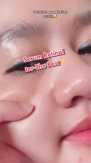 Video post by @lili.refliskin on TikTok