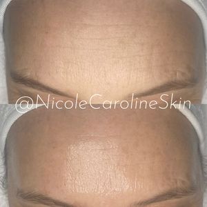 Image post by @nicolecarolineskin on Instagram