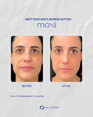 Image post by @sciton_inc on Instagram