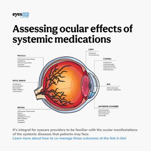 Image post by @eyesoneyecare.optometry on Instagram