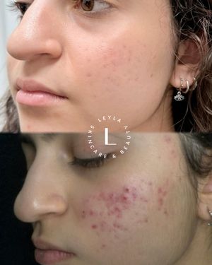 Image post by @leyla.skincareandbeauty on Instagram
