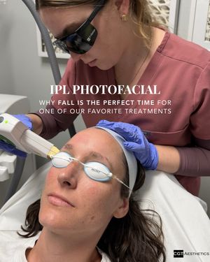 Image post by @cgtaesthetics on Instagram