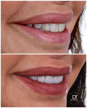 Image post by @sharpdentistry on Instagram