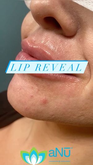 Video post by @anuaestheticsandwellness on Instagram