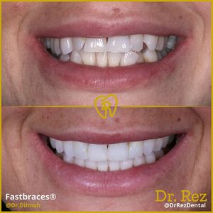 Image post by @drrezdental on Facebook