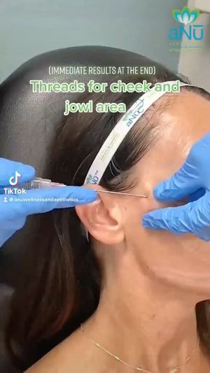 Video post by @anuaestheticsandwellness on Instagram