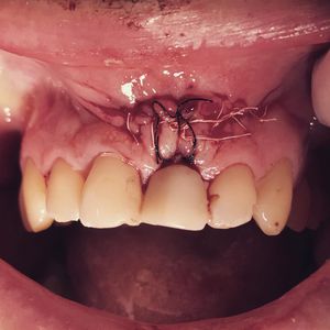 Image post by @dr.davidgarciadds on Instagram