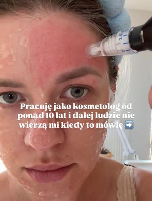 Image post by @gladkowska.kosmetolog on Instagram