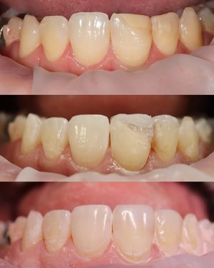 Image post by @fahaddentist on Instagram