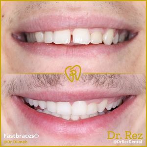 Image post by @drrezdental on Facebook