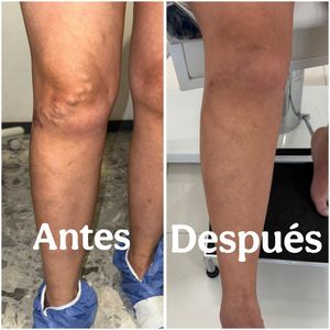 Image post by @dr.vicentevascular on Instagram