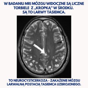 Image post by @neurochirurg_litak on Instagram