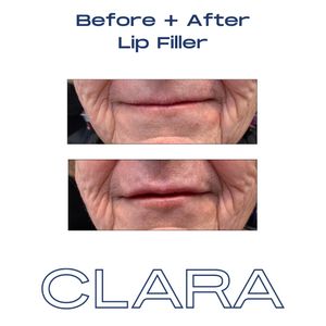 Image post by @clara.derm on Instagram