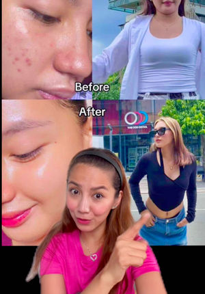 Video post by @laaainebernardo on TikTok