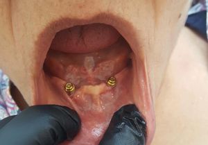 Image post by @dentamerzifon on Instagram
