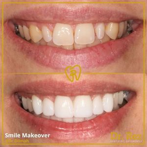 Image post by @drrezdental on Facebook