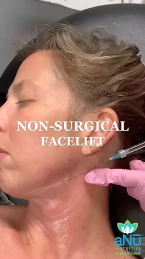 Video post by @anuaestheticsandwellness on Instagram
