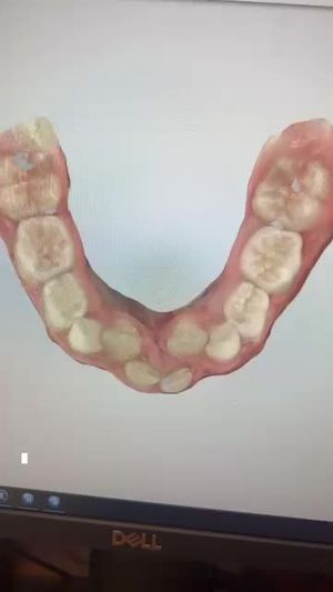 Video post by @weisstorortho on TikTok