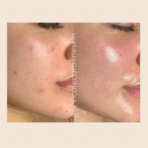 Image post by @nicolecarolineskin on Instagram