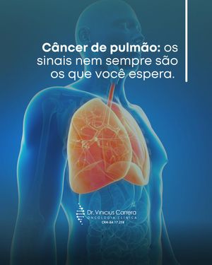 Image post by @drviniciuscarrera on Instagram