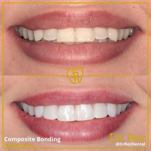 Image post by @drrezdental on Facebook