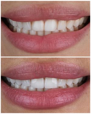 Image post by @sharpdentistry on Instagram