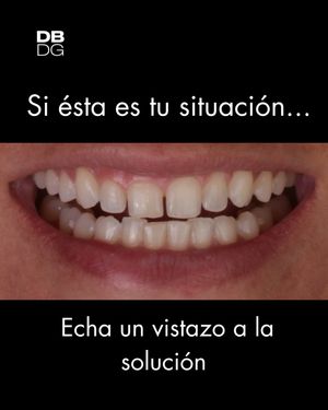 Image post by @drdelfinbarquero on Instagram