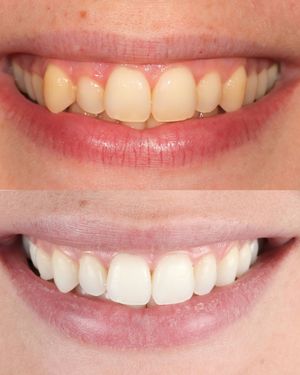 Image post by @fahaddentist on Instagram