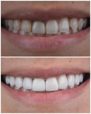 Image post by @sharpdentistry on Instagram