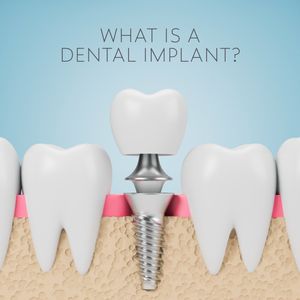 Image post by @sharpdentistry on Instagram