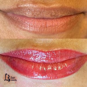 Image post by @leyla.skincareandbeauty on Instagram