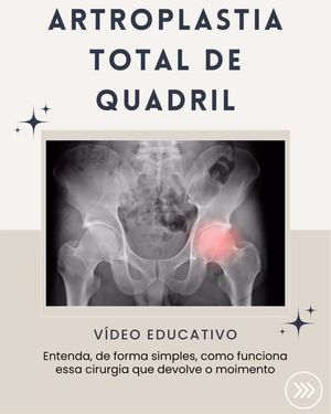 Image post by @drlucianofontes on Instagram