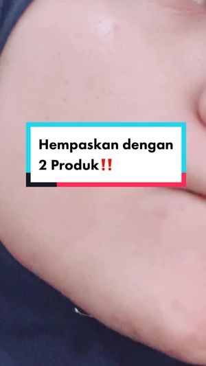 Video post by @lili.refliskin on TikTok