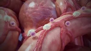 Video post by @nucleusmedicalmedia on YouTube